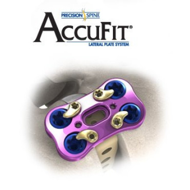 AccuFit® Lateral Plate System